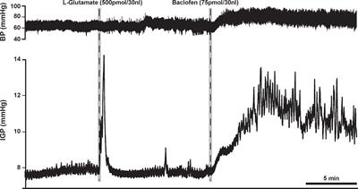 GABAB Receptor Signaling in the Dorsal Motor Nucleus of the Vagus Stimulates Gastric Motility via a Cholinergic Pathway